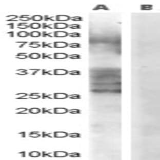 anti-ADAM Metallopeptidase Domain 33 (ADAM33) (Internal Region) antibody avatar