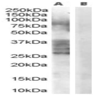 anti-ADAM Metallopeptidase Domain 33 (ADAM33) (Internal Region) antibody avatar