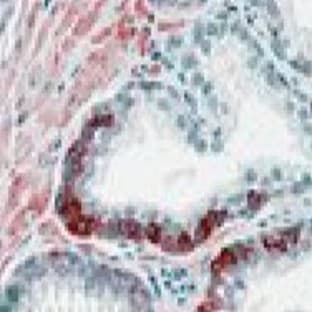 anti-ADAM Metallopeptidase Domain 12 (ADAM12) (N-Term) antibody avatar