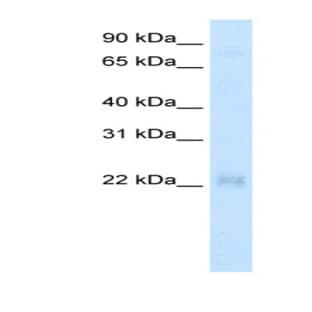 anti-Cysteine and Glycine-Rich Protein 3 (CSRP3) (Middle Region) antibody avatar
