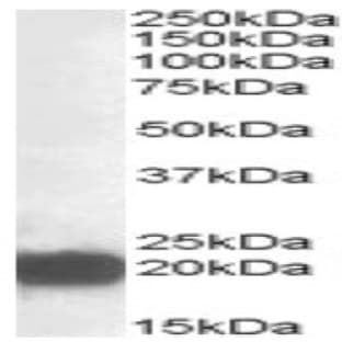 anti-Cysteine and Glycine-Rich Protein 3 (CSRP3) (Internal Region) antibody avatar