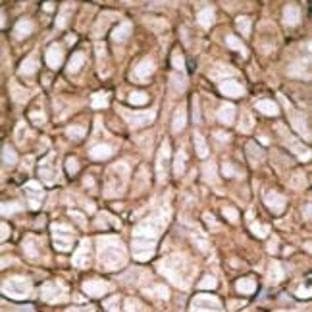 anti-Pyruvate Dehydrogenase Complex, Component X (PDHX) (C-Term) antibody