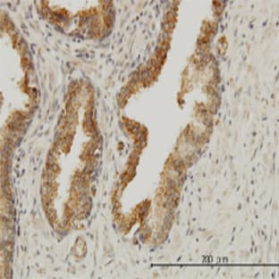 anti-Achalasia, Adrenocortical Insufficiency, Alacrimia (AAAS) (AA 1-101) antibody avatar