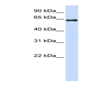 anti-3'-phosphoadenosine 5'-phosphosulfate Synthase 2 (PAPSS2) (C-Term) antibody avatar