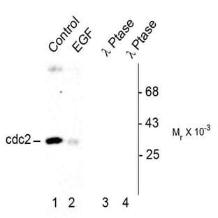 anti-Cyclin-Dependent Kinase 1 (CDK1) (pTyr15) antibody avatar