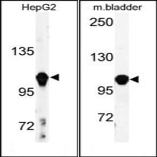 anti-Actinin, alpha 4 (ACTN4) (C-Term) antibody avatar