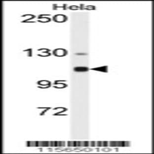 anti-Actinin, alpha 4 (ACTN4) (N-Term), (AA 192-220) antibody avatar