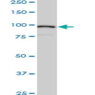 anti-Actinin, alpha 4 (ACTN4) (AA 592-702) antibody avatar