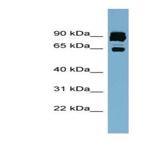 anti-CLPTM1-Like (CLPTM1L) (Middle Region) antibody avatar