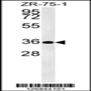 anti-D4, Zinc and Double PHD Fingers, Family 3 (DPF3) (AA 143-171), (Center) antibody avatar