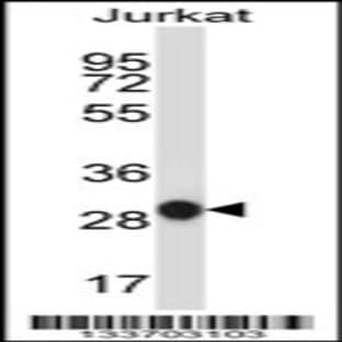 anti-Acidic (Leucine-Rich) Nuclear phosphoprotein 32 Family, Member A (ANP32A) (AA 133-162), (Center) antibody avatar