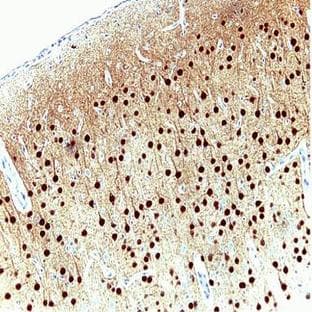 anti-Calcium/calmodulin-Dependent Protein Kinase IV (CAMK4) (AA 1-241) antibody