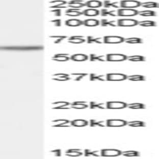 anti-Cysteine-serine-Rich Nuclear Protein 2 (CSRNP2) antibody avatar