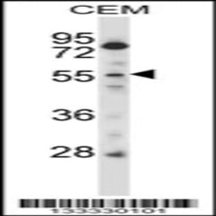 anti-Cysteine-serine-Rich Nuclear Protein 2 (CSRNP2) (C-Term), (AA 509-538) antibody avatar