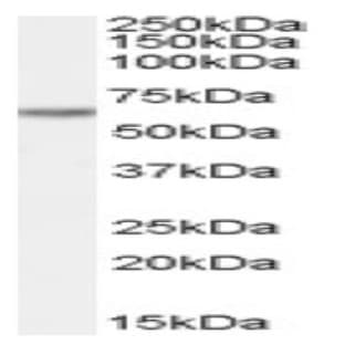 anti-Cysteine-serine-Rich Nuclear Protein 2 (CSRNP2) (Internal Region) antibody avatar