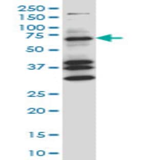anti-Coilin (COIL) (AA 477-576) antibody avatar