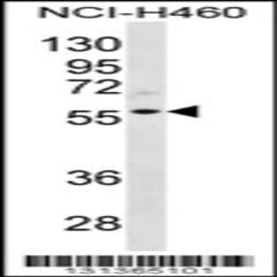 anti-Cyclin L2 (CCNL2) (AA 338-366), (Center) antibody avatar