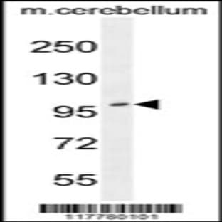 anti-ADAM Metallopeptidase with Thrombospondin Type 1 Motif, 10 (ADAMTS10) (N-Term), (AA 210-240) antibody avatar