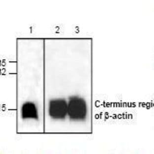anti-Actin, beta (ACTB) antibody avatar