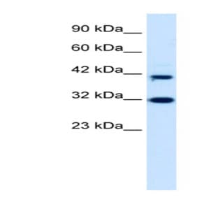anti-D4, Zinc and Double PHD Fingers Family 1 (DPF1) (Middle Region) antibody avatar