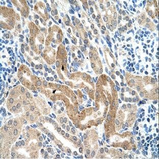 anti-Chromatin Assembly Factor 1, Subunit B (p60) (CHAF1B) (C-Term) antibody avatar