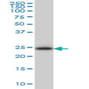 anti-Chromosome 21 Open Reading Frame 33 (C21orf33) (AA 188-269) antibody avatar