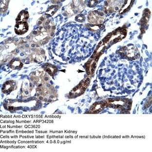 anti-A Kinase (PRKA) Anchor Protein 17A (AKAP17A) (N-Term) antibody avatar