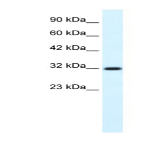 anti-AChE Q Subunit (N-Term) antibody avatar