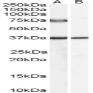 anti-Acyl-CoA Oxidase 2, Branched Chain (Acox2) (C-Term), (Internal Region) antibody avatar