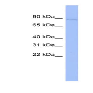 anti-Cysteinyl-tRNA Synthetase (CARS) (N-Term) antibody avatar