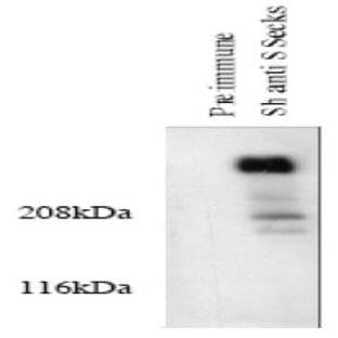 anti-A Kinase (PRKA) Anchor Protein 12 (AKAP12) (AA 620-1596) antibody avatar