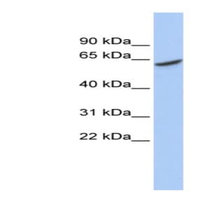 anti-ADP-Dependent Glucokinase (ADPGK) (Middle Region) antibody avatar