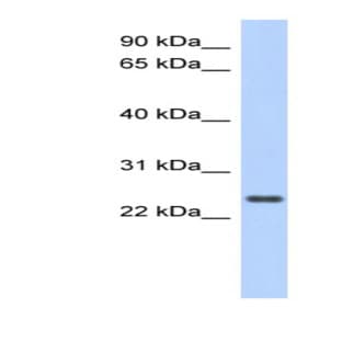 anti-Coiled-Coil Domain Containing 70 (CCDC70) (Middle Region) antibody avatar