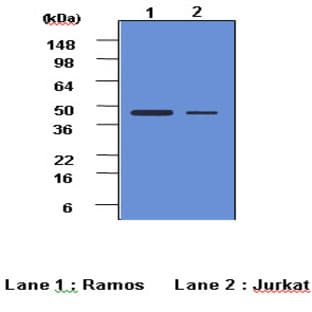 anti-Caspase 2, Apoptosis-Related Cysteine Peptidase (CASP2) (AA 32-169) antibody avatar