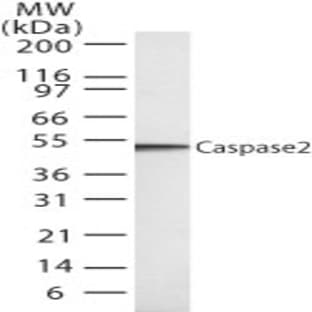 anti-Caspase 2, Apoptosis-Related Cysteine Peptidase (CASP2) antibody avatar