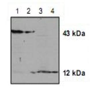 anti-Caspase 2, Apoptosis-Related Cysteine Peptidase (CASP2) antibody avatar