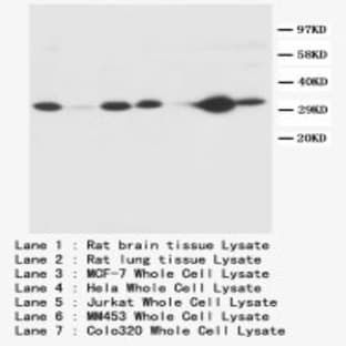 anti-Caspase 3, Apoptosis-Related Cysteine Peptidase (CASP3) (C-Term) antibody avatar