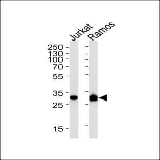 anti-Caspase 3, Apoptosis-Related Cysteine Peptidase (CASP3) antibody avatar