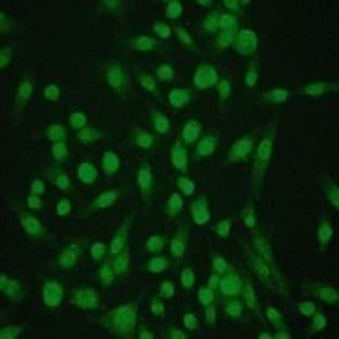 anti-Caspase 3, Apoptosis-Related Cysteine Peptidase (CASP3) (Ser29), (N-Term) antibody avatar