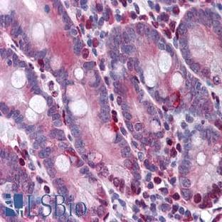 anti-Caspase 3, Apoptosis-Related Cysteine Peptidase (CASP3) (N-Term) antibody avatar