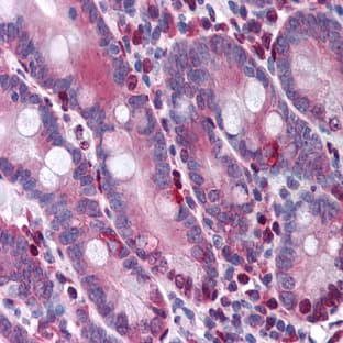 anti-Caspase 3, Apoptosis-Related Cysteine Peptidase (CASP3) antibody avatar