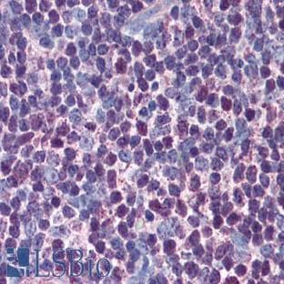 anti-Caspase 3, Apoptosis-Related Cysteine Peptidase (CASP3) antibody avatar