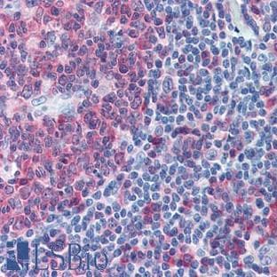 anti-Caspase 3, Apoptosis-Related Cysteine Peptidase (CASP3) antibody avatar