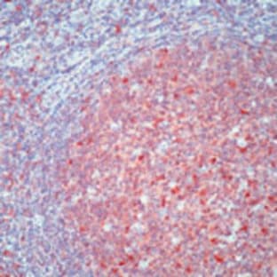 anti-Caspase 3, Apoptosis-Related Cysteine Peptidase (CASP3) antibody avatar