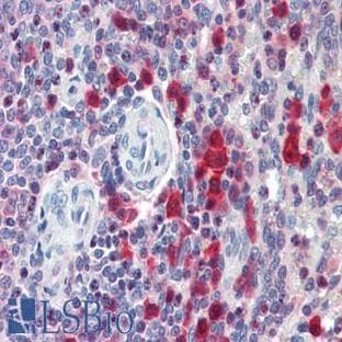 anti-Caspase 3, Apoptosis-Related Cysteine Peptidase (CASP3) antibody avatar