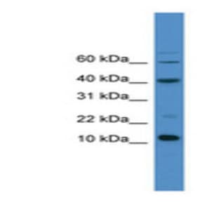 anti-Caspase 3, Apoptosis-Related Cysteine Peptidase (CASP3) (C-Term) antibody avatar