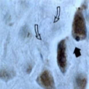 anti-Caspase 3, Apoptosis-Related Cysteine Peptidase (CASP3) antibody avatar