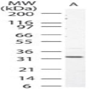 anti-Caspase 3, Apoptosis-Related Cysteine Peptidase (CASP3) antibody avatar