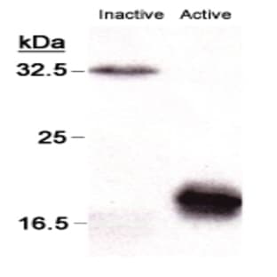 anti-Caspase 3, Apoptosis-Related Cysteine Peptidase (CASP3) antibody avatar