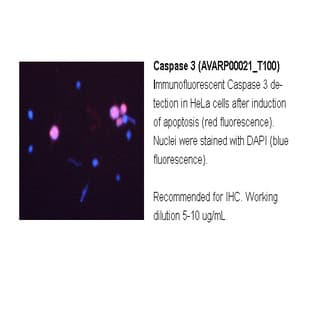 anti-Caspase 3, Apoptosis-Related Cysteine Peptidase (CASP3) (N-Term) antibody avatar
